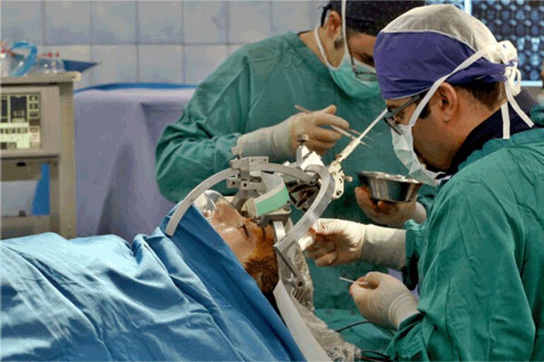 علائم اولیه تومور مغزی