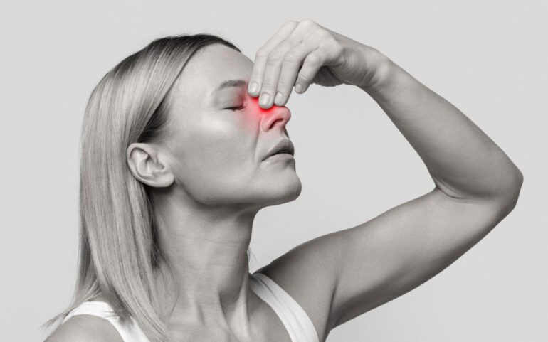 علائم سینوزیت مزمن