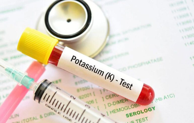درمان فوری کمبود پتاسیم