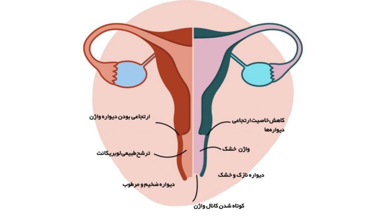 علت خشکی واژن در زنان جوان